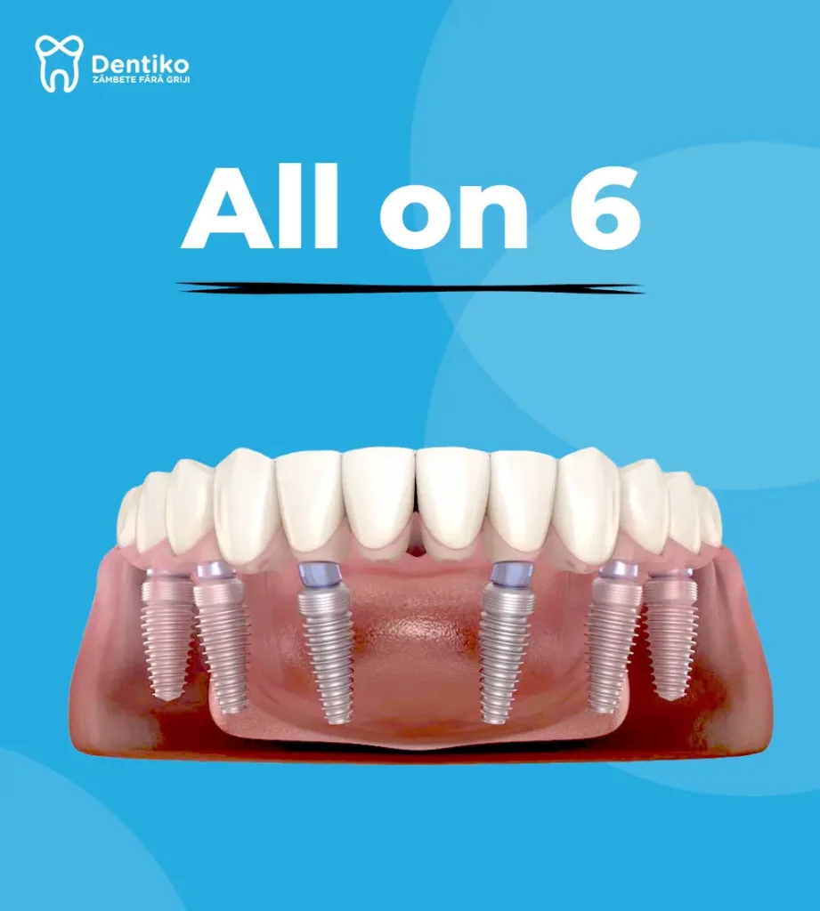 dentiko, dinti ficsi in 24 ore