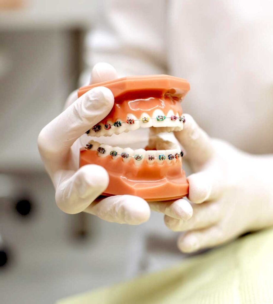 dentiko, otodontie